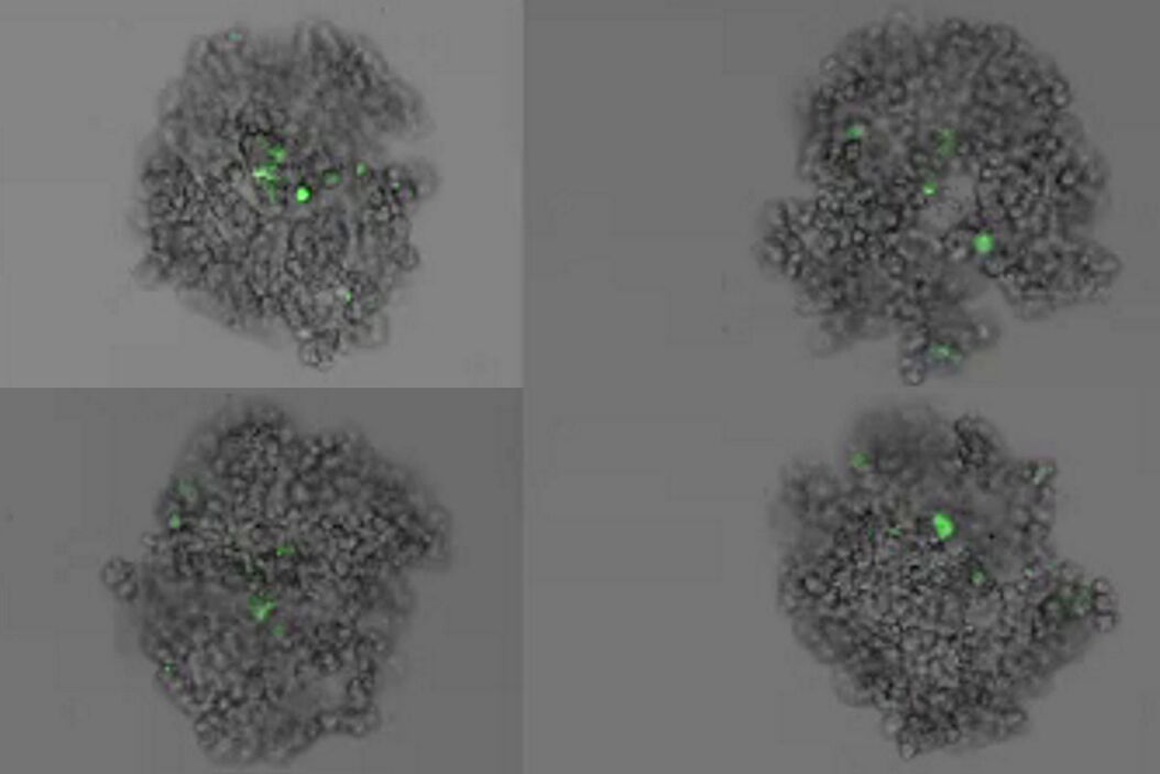 Formation of 3D spheroids; Time lapse acquisition over 72 hours  Formation_of_3D_spheroids_from_MX1-GFP_cells.jpg
