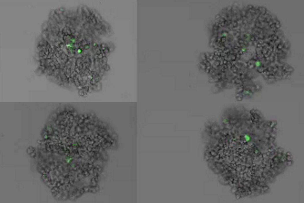 Bildung von 3D-Sphäroiden aus 1000 MDCK-Zellen pro Vertiefung, wobei die Zellen stabil mit MX1 GFP (grün) transfiziert wurden. Zeitrafferaufnahmen über 72 Stunden mit einem Intervall von 30 Minuten. Grau ist der integrierte Modulationskontrast. Formation_of_3D_spheroids_from_MX1-GFP_cells.jpg