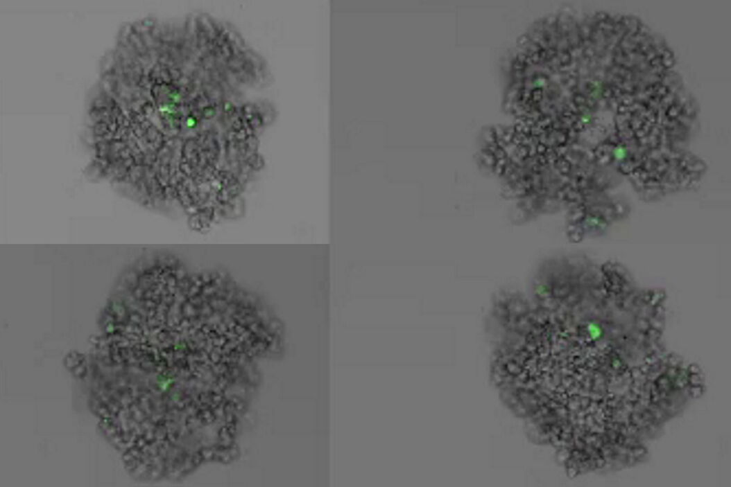 [Translate to German:] Formation of 3D spheroids; Time lapse acquisition over 72 hours  Formation_of_3D_spheroids_from_MX1-GFP_cells.jpg