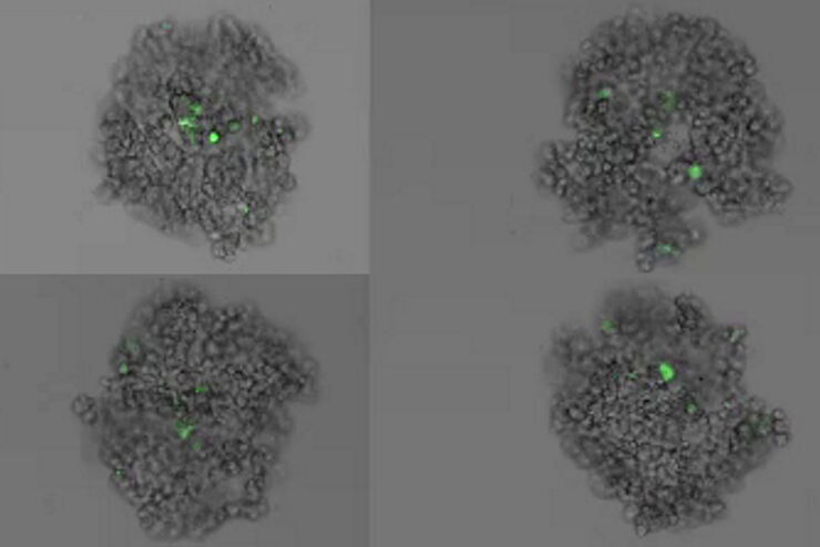 [Translate to German:] Formation of 3D spheroids; Time lapse acquisition over 72 hours 