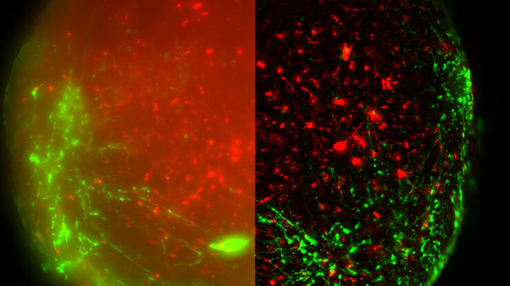 Virally labeled neuron - THUNDER Imager Model Organism