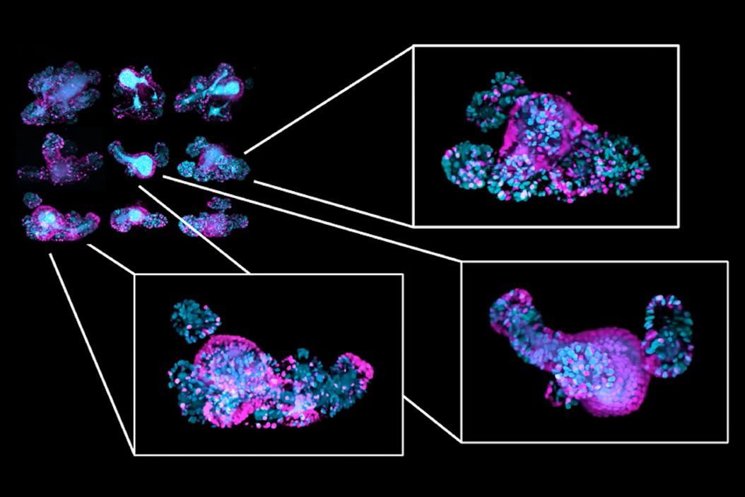 Long-term in toto imaging of FUCCI2 intestinal organoids. Long-term_in_toto_imaging_of_FUCCI2_intestinal_organoids.jpg