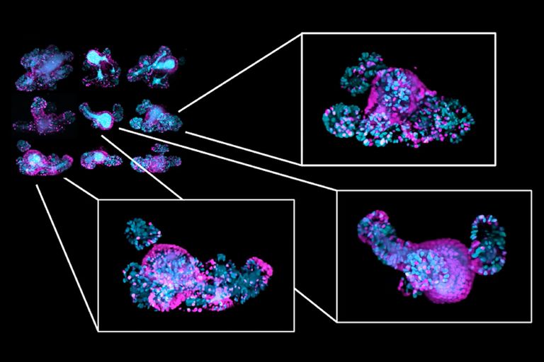 Multiscale Imaging of Organoids: High Content to Light Sheet | Learn ...