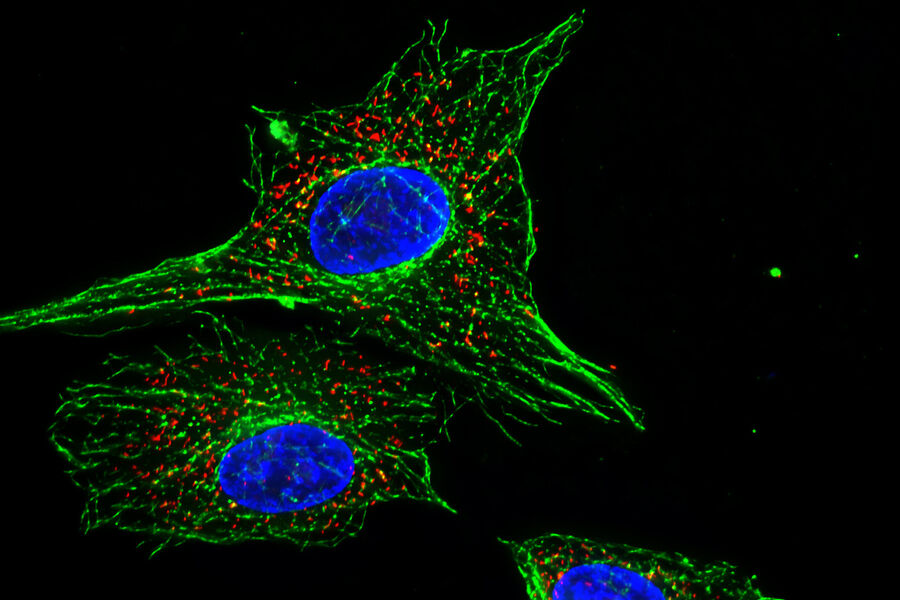 Figure 1: Fluorescently labelled cells visualized by fluorescence microscopy.