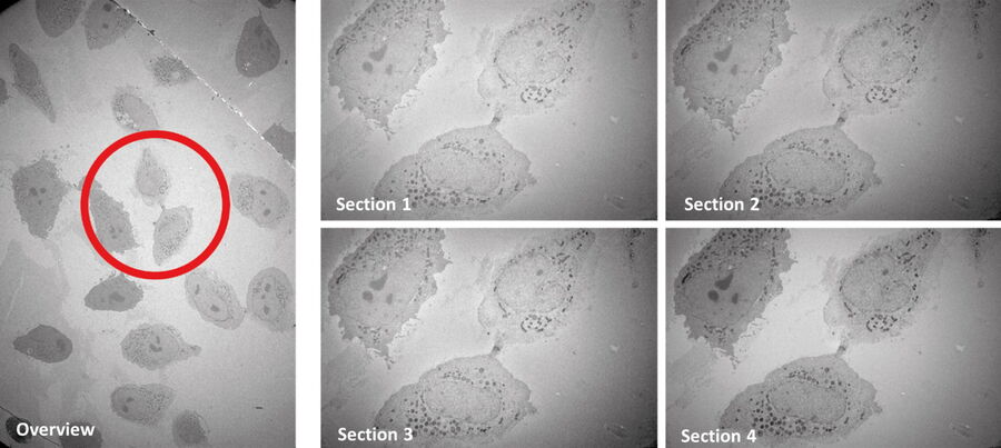 Merged TEM image of the dividing HeLa cells, still connected by the intercellular bridge.