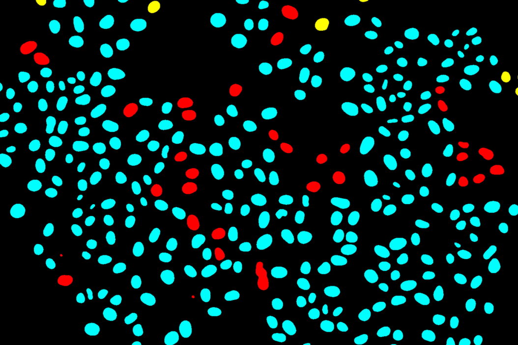 Separation of cells based on their tracking status: A colourised binary mask of a time-lapse microscopy field of view of medium confluency with individual cells highlighted as survivors if they can be tracked since the initial movie frame (cyan), incomers if they migrated into the field of view throughout the movie (yellow) or mistracks if an error occurred in the automated trajectory reconstruction (red). Tracking_single_cells_using_deep_learning_teaser.jpg
