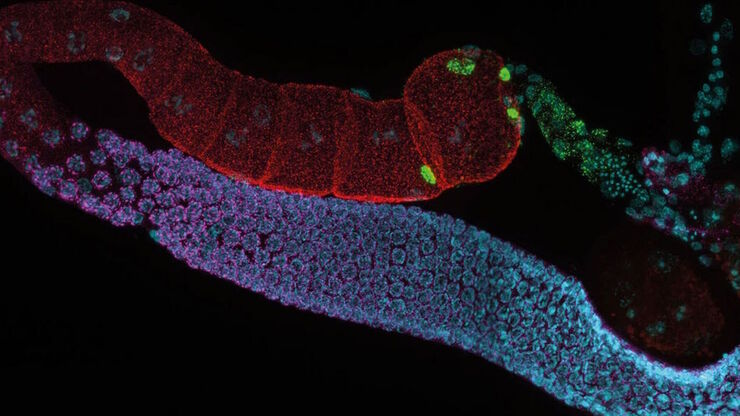 Ausgewachsene hermaphroditische Gonaden von C. elegans, aufgenommen mit THUNDER Imager. Färbung: blau - DAPI (Zellkern), grün - SP56 (Spermien), rot - RME-2 (Eizelle), magenta - PGL-1 (RNA + Proteingranula). Bild mit freundlicher Genehmigung von Prof. Dr. Christian Eckmann, Martin-Luther-Universität, Halle, Deutschland.