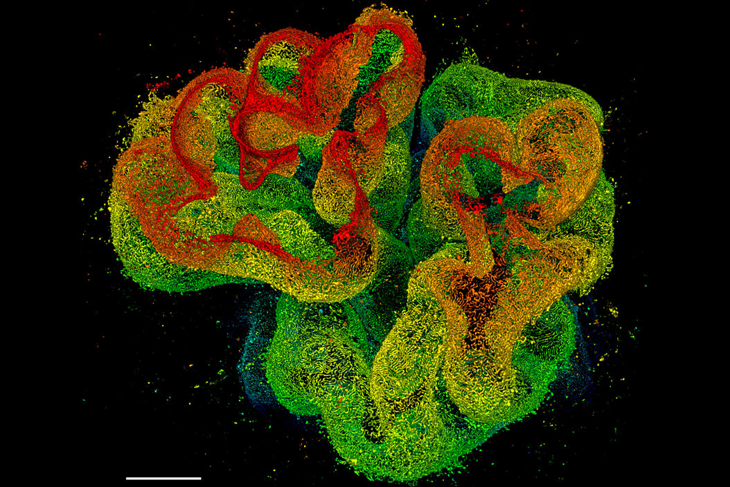  Kidney-3D-Sted.jpg