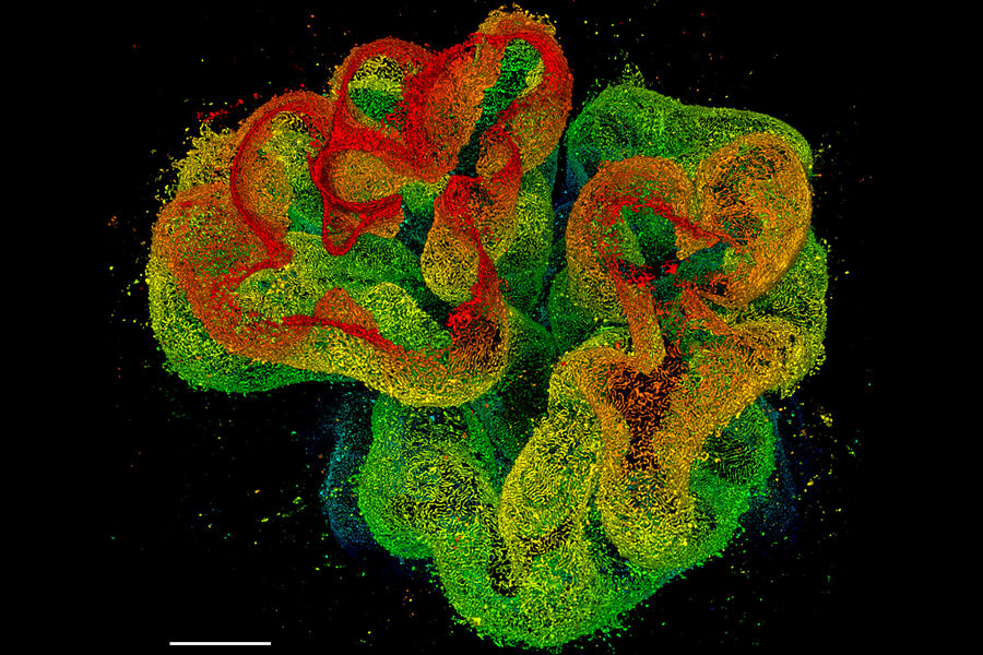 3D STED 775 deep nanoscopy of glomerulus in cleared kidney tissue immunostained for nephrin. 