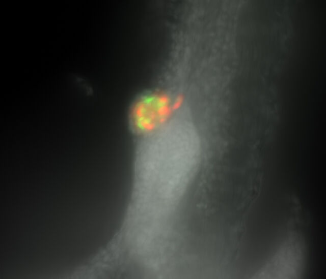 Developing zebrafish pancreas - Widefield image Developing zebrafish pancreas - Widefield image