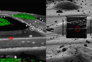 Correlation of markers in the LM and the FIB image.