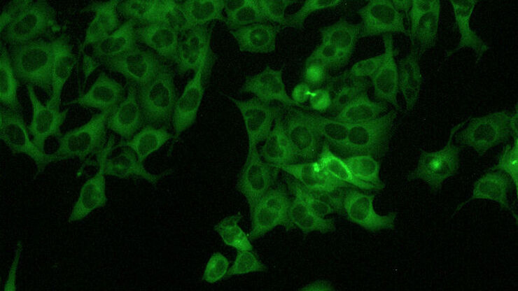 [Translate to German:] HeLa Cells 20x Fluorescence