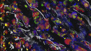 Colon tumor cells, fluorescently labelled and lineage traced from a multicolor tracer. 