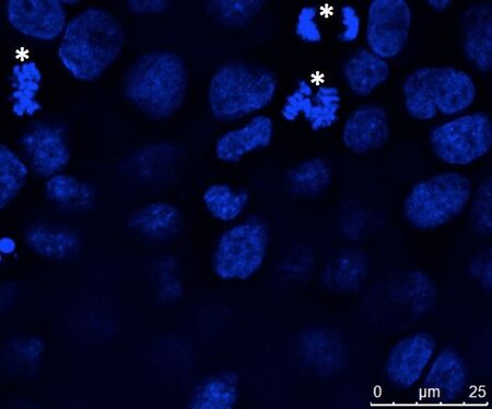 Adherently growing epithelial cells (MDCK) were cultivated on coverslips, fixed and nuclei were stained with Hoechst 33342