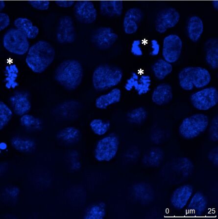 Adhärent wachsende Epithelzellen (MDCK) wurden auf Deckgläsern kultiviert, fixiert und die Zellkerne mit Hoechst 33342 gefärbt.