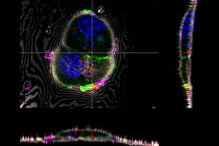 LAS X Coral Cryo: Interpolationsbasiertes Targeting in 3D unter Verwendung von Schnitten durch den Z-Stack in x- und y-Richtung. Die Marker können interaktiv in allen relevanten Fenstern verschoben werden.