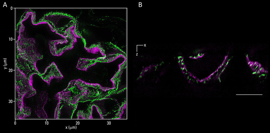 Two color, 2D STED and 3D STED imaging of mouse kidney section immunostained for synaptopodin and nephrin