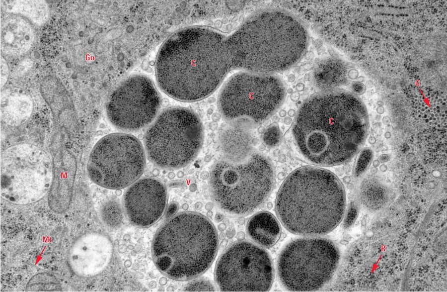 Higher magnification of inclusion of cell in Figure 1. (C), Chlamydia pneumoniae cells; (G), Glycogen granules; (Go), Golgi; (M), Mitochondrium; (Mt), Microtubules; (R), Ribosomes; (V), Vesicles. Scale bar 500 nm (courtesy of Kaech A, Center for Microscopy and Image Analysis, University of Zurich, Switzerland); related instrument: Leica EM HPM100.