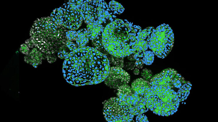 Aivia two color organoid cluster
