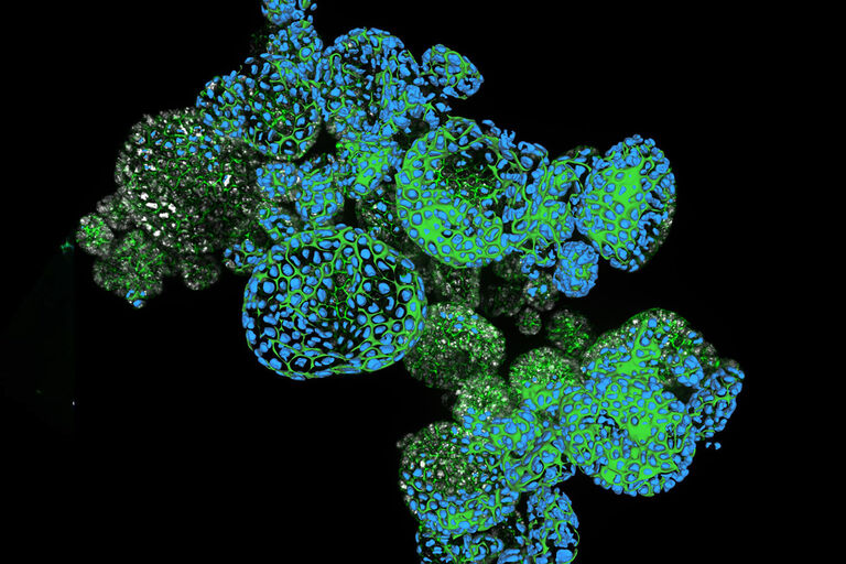 Dapi – Nucleus, GFP – Plasma Membrane, Thickness 100µm, 63x objektive, 469 Z planes, 2 channels, THUNDER Imager 3D Cell Culture. Courtesy M.Sc. Dana Krauß, Medical University of Vienna (Austria).