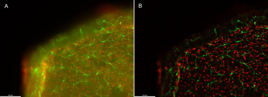 Figure 1: Widefield imaging (A) and THUNDER (B) snapshot of the whole-mounted retina. Microglia (Iba1, green) and retinal ganglion cells (Brn3a, red). Sample courtesy of the Experimental Ophthalmology Group, University of Murcia, Spain.