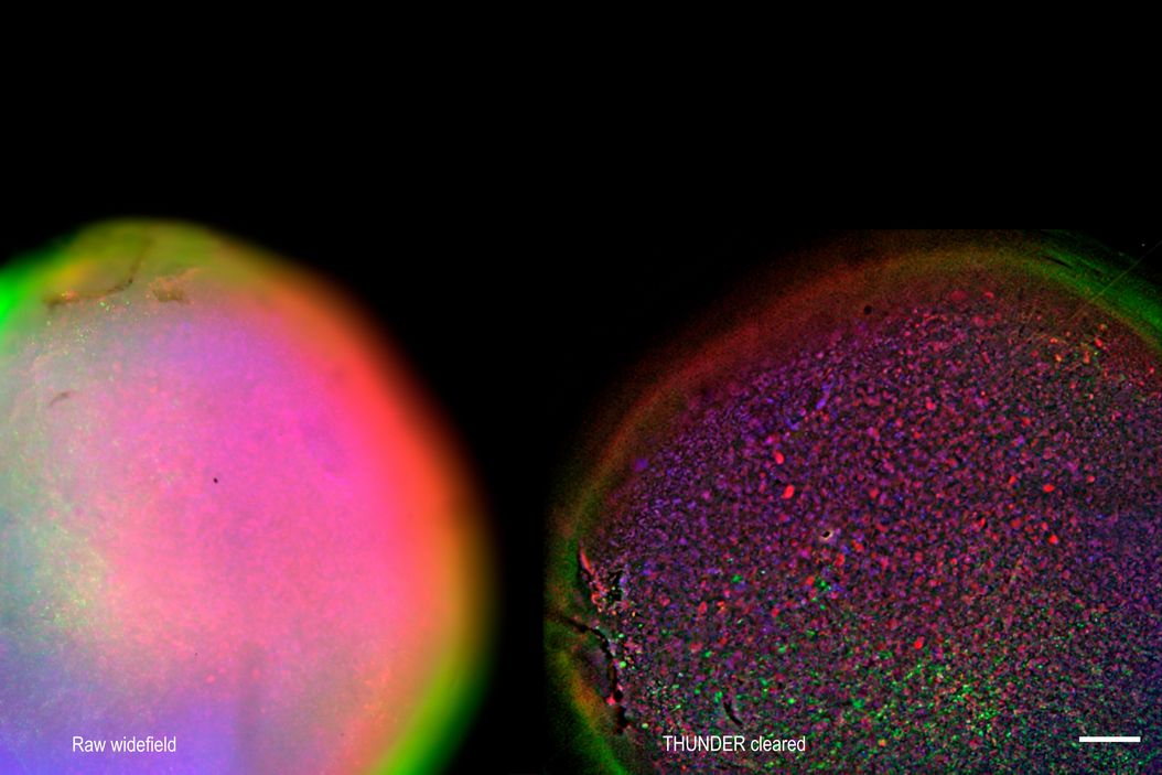 Large field of view (FOV) 2D slices of a 1 mm diameter midbrain neural organoid stained with DAPI (blue, nuclear stain), β-tubulin (green, neuronal stain), and GFAP (red, astrocyte stain). Acquired on THUNDER Imager Cell with 10x magnification. Left: Raw widefield image, Right: THUNDER cleared image. Scale bar 400 μm. Sample courtesy of Dr Tanya Singh, University of Oxford, UK. 2D_slices_of_midbrain_neural_organoid.jpg