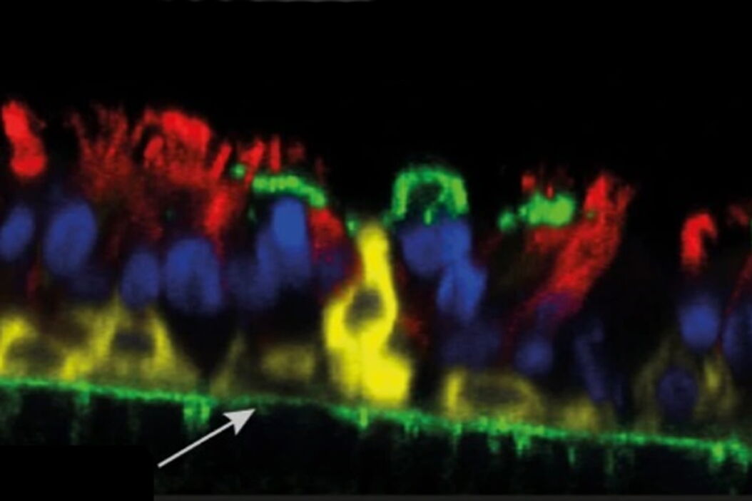 Confocal imaging of a SARS-CoV-2-infected epithelia at 4 dpi (orthogonal sections) STELLARIS_contributes_to_understanding_COVID-19_teaser.jpg