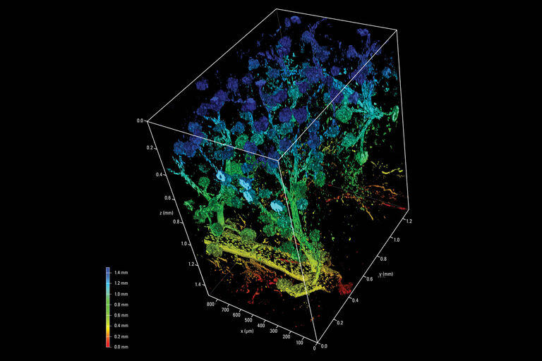 Les méthodes de transparisation des tissus les plus modernes permettent un accès optique au niveau subcellulaire à des tissus intacts provenant d’organes individuels. Cette image montre un échantillon de rein de souris transparisé, obtenu à l’aide de l’objectif multi-immersion 16x. L’illumination a été réalisée à 730 nm. Avec l’aimable autorisation du professeur Gretz, Université de Mannheim, Allemagne.