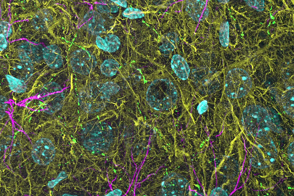 Csm 3D THUNDERed Spinning Disk Image Of Mouse Brain E52c80e875