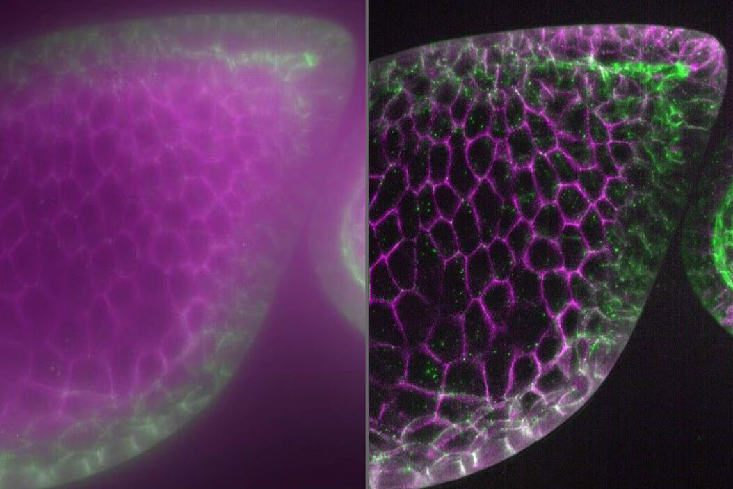 Raw widefield and THUNDER image of Drosophila follicles. Image courtesy of M. Khoury and D. Bilder, University of California, Berkeley, USA. Drosophila_follicles_Raw_widefield_and_THUNDER_teaser.jpg