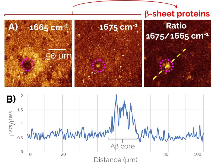 Two-color SRS procedure; visualization of pathological Aβ aggregates