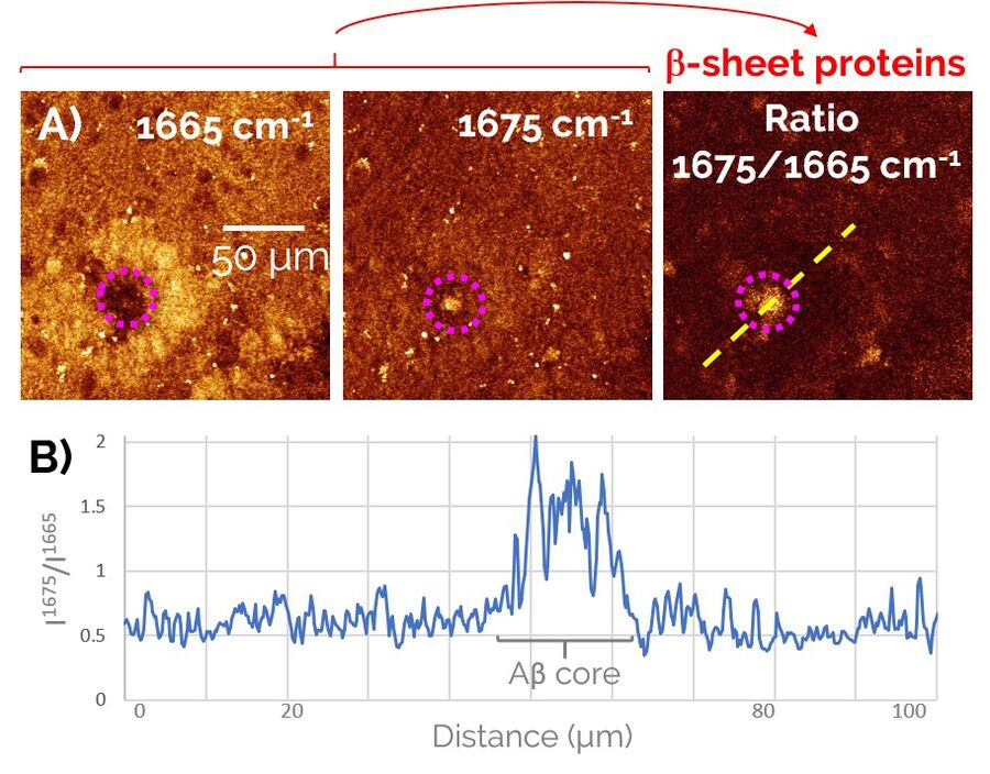 Two-color SRS procedure; visualization of pathological Aβ aggregates 