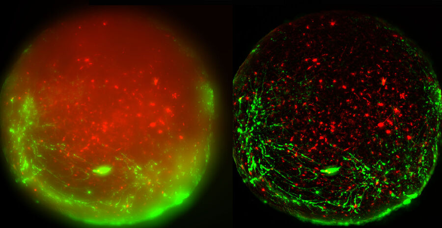 Virally labeled neurons (red) and astrocytes (green) in a cortical spheroid derived from human induced pluripotent stem cells. THUNDER Model Organism Imagerwith a 2x 0.15 NA objective at 3.4x zoomwas used to produce this 425 μm Z-stack (26 positions), which is presented here as an Extended Depth of Field (EDoF) projection. The THUNDER Imager Model Organism offers the ability to freely zoom, for easy observation of whole spheres, and distinct regions, for easy screening. Images courtesy of Dr. Fikri Birey from the Dr. Sergiu Pasca laboratory, CA, USA.