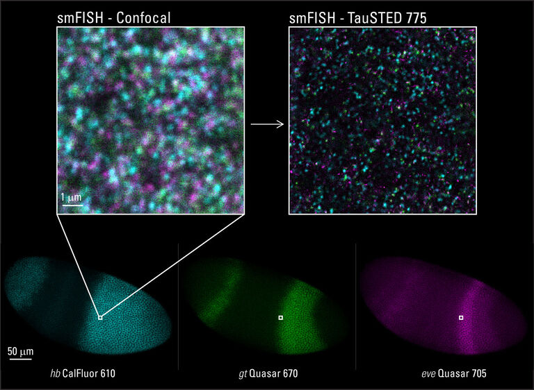 STED for Developmental Biology: smFISH* of RNA in a Drosophila embryo whole-mount preparation. Probes are directly labeled and there is no signal amplification. Top: Three color TauSTED 775 captures the signal from hb CalFluor 610 (cyan), gt Quasar 670 (green), and eve Quasar 705 (magenta). Bottom: confocal imaging of the whole Drosophila embryo. Sample courtesy of Tom Pettini, University of Manchester, UK.
*Single molecule in-situ hybridization
