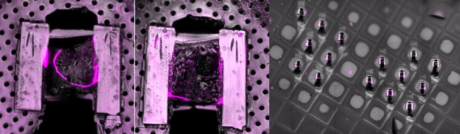 Cryo-confocal fluorescence imaging of the milled lamella on the TEM grid after cryo-FIB preparation. Residual fluorescence signal confirms that the targeted region of interest—containing malaria parasite structures—has been successfully retained during lamella preparation, supporting accurate correlation between cryo-fluorescence microscopy and cryo-electron microscopy workflows. The two images on the left are high-magnification views of two regions within the lamellae shown on the right, used for cryo-electron tomography.