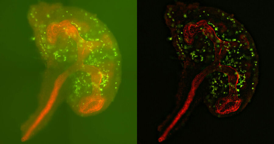 Mouse embryonic kidney at day 12.5. E-Cadherin (red), unspecific (green). Sample prepared by MSc Kristen Kurtzeborn and used courtesy of Prof. Satu Kuure, Kidney Development group, University of Helsinki, Finland. Sample imaged by Janne Ylärinne, PhD, Immuno Diagnostic Oy.