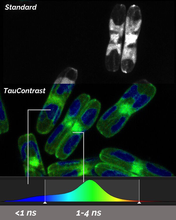 Diatoms examined with TauContrast. 