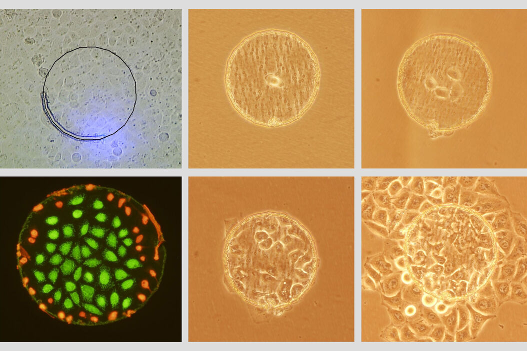  Intro_Image_LMD_CellIsolation.JPG