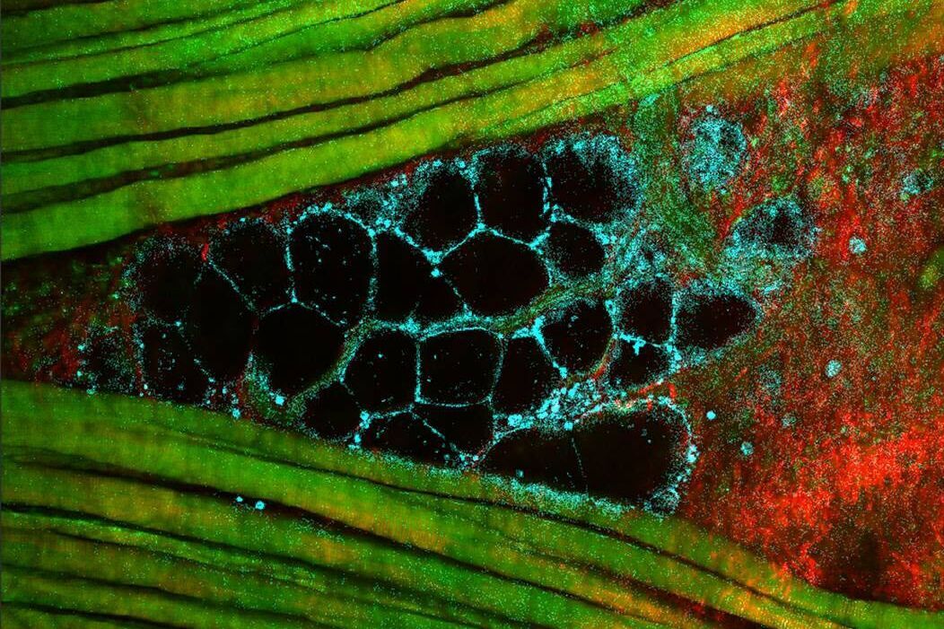 Multiphoton microscopy of an unstained mouse skin section acquired using the 4Tune detector.  Mission_Impossible_Accomplished_Intro.jpg