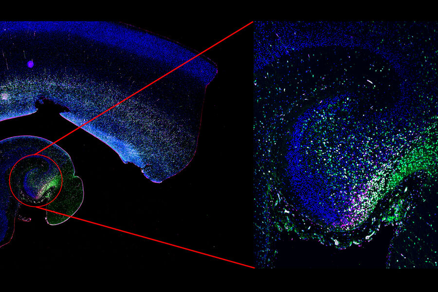 Ippocampo umano. Progenitori neuronali proliferanti marcati con Ki67 (rosso), MCM2 (magenta) e SOX2 (verde) nel cervello umano durante lo sviluppo. A sinistra: panoramica rapida acquisita in modalità widefield. Ippocampo umano. Progenitori neuronali proliferanti marcati con Ki67 (rosso), MCM2 (magenta) e SOX2 (verde) nel cervello umano durante lo sviluppo. A sinistra: panoramica rapida acquisita in modalità widefield. A destra: scansione ad alta risoluzione in modalità confocale. Immagine fornita su gentile concessione di Piero Rigo, studente PhD presso il Francis Crick Institute, Londra, Regno Unito.