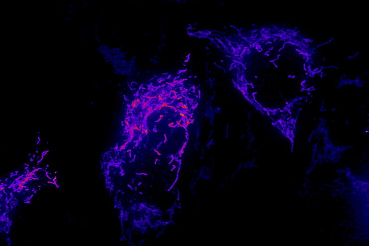 Image of fixed U2OS cell expressing mEmerald-Tomm20 denoised using a 3D RCAN model trained with matching low and high SNR image pairs acquired on an iSIM system.