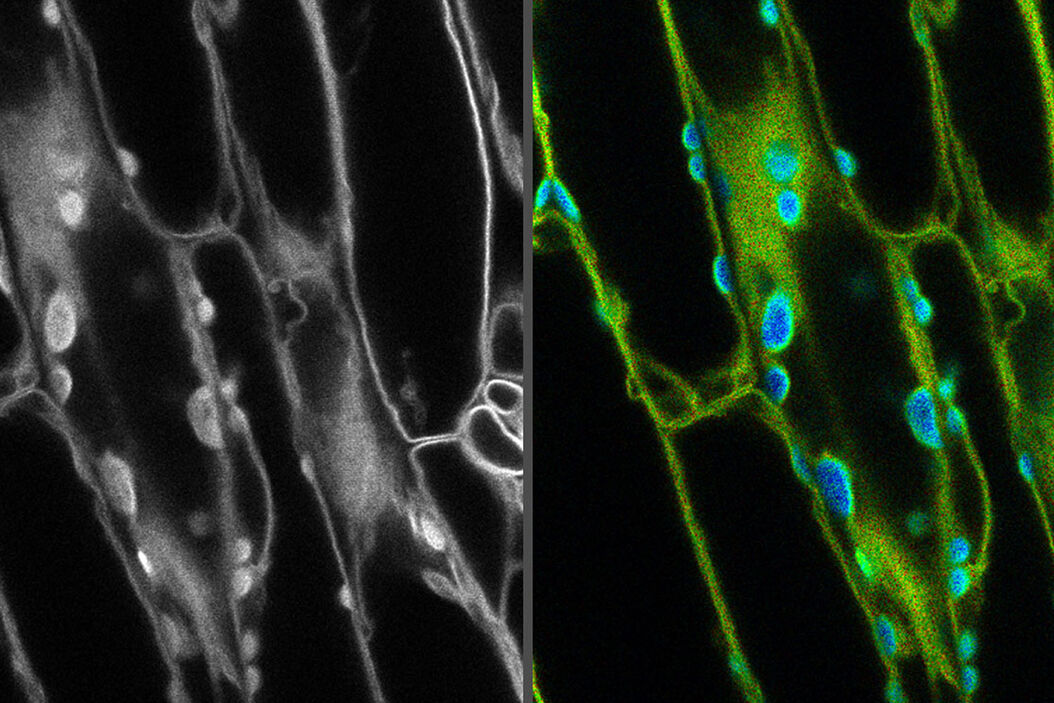 Fluorescence microscopy image on the left with no distinction between the fluorescent signal and background autofluorescence. FLIM was used in the image on the right to differentiate autofluorescence in chloroplasts (blue) from the desired fluorescent signal from the cell membrane (green). how-to-remove-autofluoresce.jpg