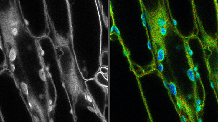 Fluorescence microscopy image on the left with no distinction between the fluorescent signal and background autofluorescence. FLIM was used in the image on the right to differentiate autofluorescence in chloroplasts (blue) from the desired fluorescent signal from the cell membrane (green).