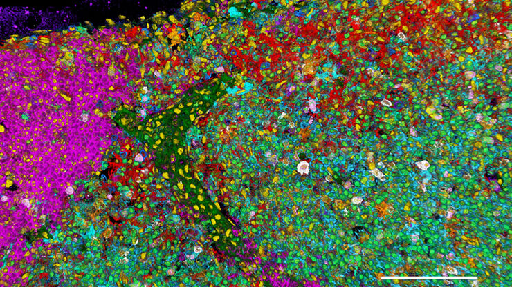 Csm Cell Phenotype Distribution With 3D 15 Plex Imaging In Murine Lymph Node 892341f7af
