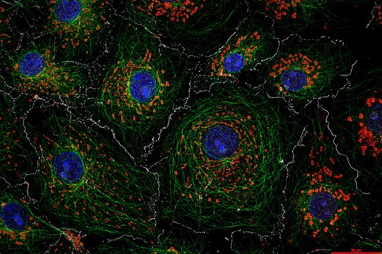 Uma imagem THUNDER de células COS7 marcada com DAPI (núcleos), anticorpo antitubulina, Mitotracker* (mitocôndria) e E-caderina. Cortesia do Prof. Ralf Jacob, Universidade de Marburg