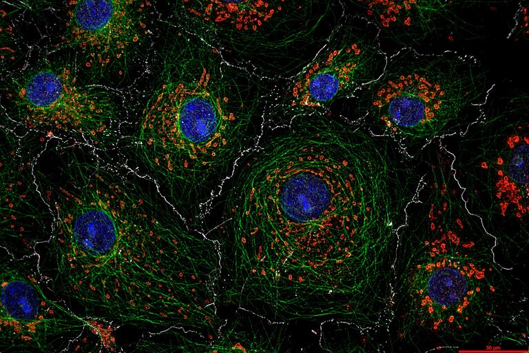 Una imagen THUNDER de células COS7 teñidas con DAPI (núcleos), anticuerpo anti-Tubulina y Mitotracker* (mitocondria), y E-cadherina. Imagen cedida por el Prof. Ralf Jacob, Universidad de Marburgo, Alemania