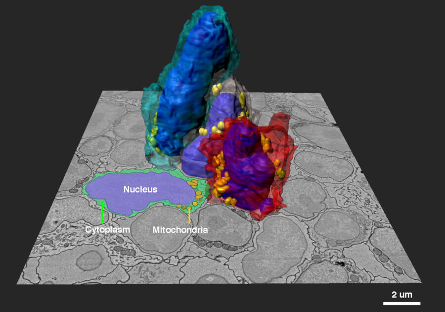 3D image reconstruction of mouse lymph nodes acquired with array tomography.