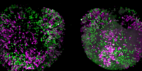 Brain organoids labeled with lamin (green) and tubulin (magenta), acquired using Viventis Deep Dual View Light Sheet Microscope. Courtesy of Akanksha Jain, Treutlein Lab ETH-DBSSE Basel (Switzerland).