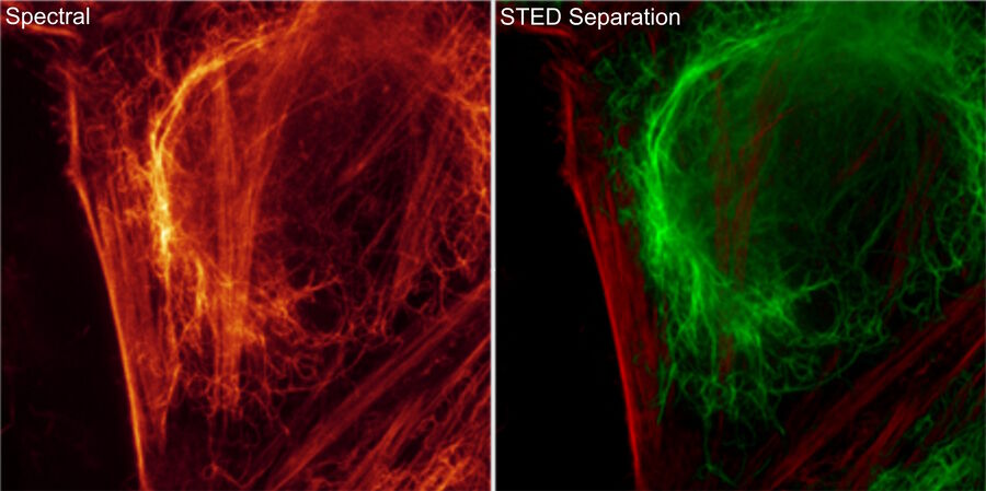 Figure 2: Species separation using STED Separation. HEK cells immunolabeled for Vimentin (left: green, AF 647) and stained for Actin (middle: magenta, ATTO 647N-phalloidin). Scale bar 4 mm. Sample Courtesy: S. Hänsch, S. Weidtkamp-Peters, CAI, Düsseldorf.