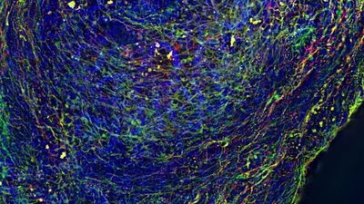 Human iPSC derived mid brain organoid. Stained with MAP2 (green), DAPI (blue) and TH (red). Image acquired using THUNDER Imager Cell Spinning Disk; scale bar 200 µm. Courtesy of Dr Tanya Singh (Salman and Wade-Martins Lab), Department of Physiology, Anatomy and Genetics, University of Oxford.